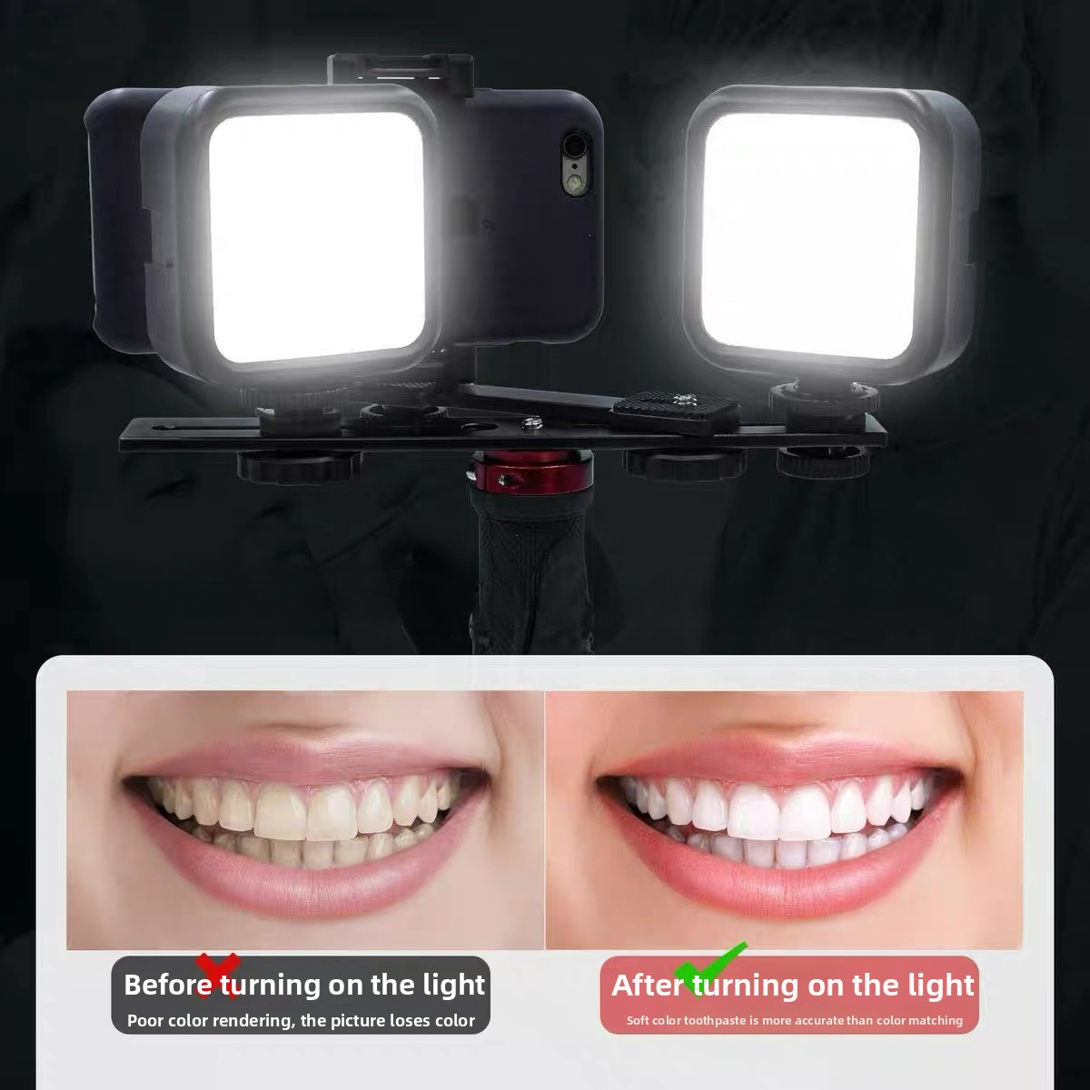 Luz de Fotografía Dental con B - Photography Basics reseña y precio